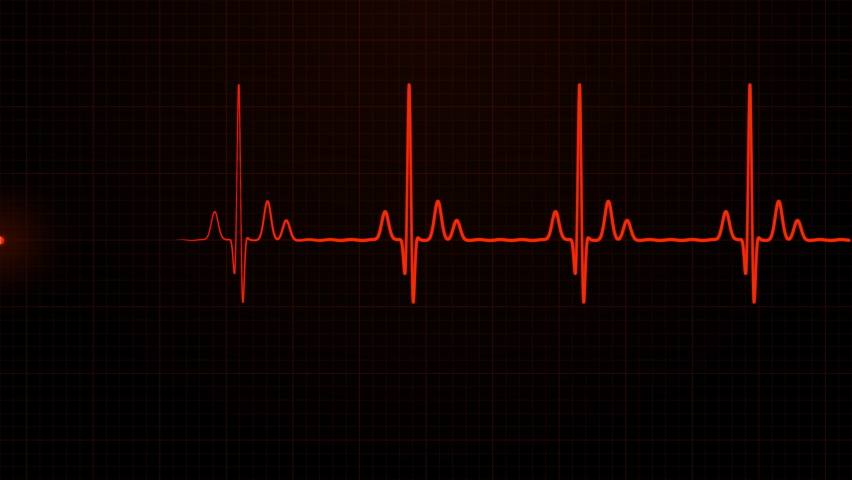 Loopable: Red ECG cardiogram oscilloscope monitor heartbeat line shows 60 BPM heart rate on black background with grid.
 Royalty-Free Stock Footage #1076324009