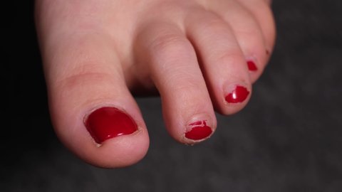 Close up view of caucasian female foot before pedicure. Unkempt nails with ugly, old, red nail polish. Foot spa, hygiene, body care, beauty treatment concept. Dark background, 4k.