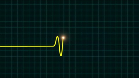 Animated Ekg Heartbeat Monitor Yellow Wave Stock Footage Video (100%  Royalty-free) 10765670 | Shutterstock