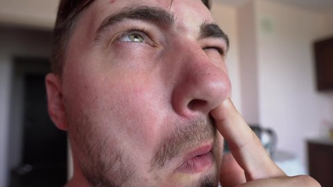 Comic Shot. Man Picking His Nose, Close-up. He Wrinkles His Face and Mimics. Stuffy Nose or Loss of Smell, Scratches his Itchy Nose