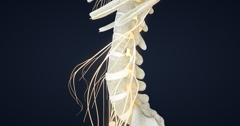 Protrusion of intervertebral discs, formation of a spinal hernia, anatomy of the spine, joint, vertebrae, Meningocele