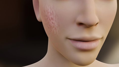 Face close-up repair effect skin dirt removal. Deep cleansing skin. Skin pores. Acne cleansing. skin pore cleaning Transparent Background. cream or serum on face to remove blemishes . 3d render