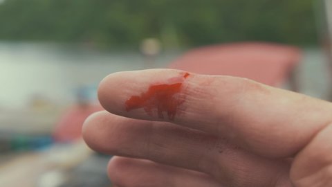 Close up of minor cut bleeding on young man's finger