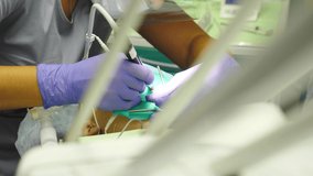 Modern dental clinic. Medical team working with sterilized tools wearing gloves during treatment in stomatological clinic. Dentist treating kids teeth. Surgical dentistry. 4 k video