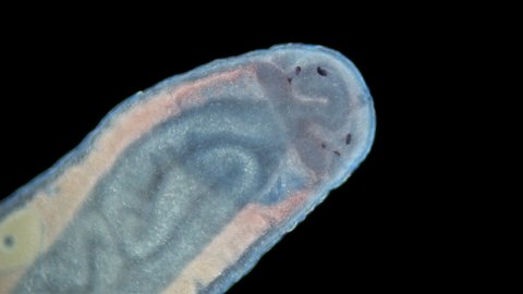 Worm Nemertea Prostoma sp. under the microscope, of the Tetrastemmatidae family. Freshwater species, predator. Close-up of head