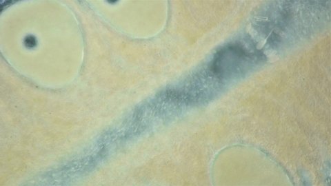 Worm Nemertea Prostoma sp. under microscope, of Tetrastemmatidae family. Freshwater species, predator. Internal organs are visible: stylet and gonads, part of intestine