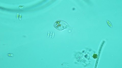 The microorganism rotates the flagellum. A drop of rainwater under a microscope. Laboratory study of the quality of drinking water. Chlorination