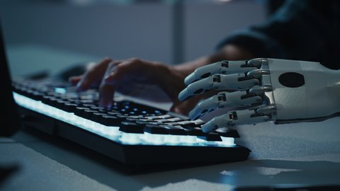 Close-up on Hands: Programmer With Disability Using Prosthetic Arm to Work on Computer Keyboard. Specialist Swift and Natural Use of Myoelectric Bionic Hand To Type for e-Commerce Software Project