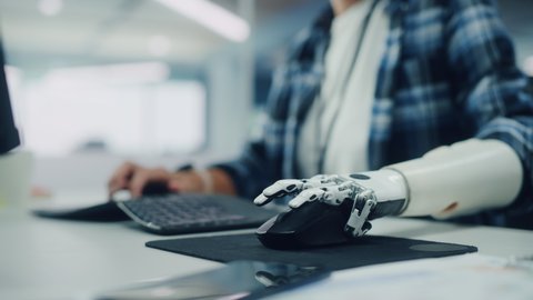Diverse Body Positive Office: Woman with Disability Using Prosthetic Arm to Work on Computer. Professional with Futuristic Thought Controlled  Myoelectric Bionic Hand. Tilt from Hand to Portrait