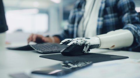 Inclusive Office: Person with Disability Using Prosthetic Arm to Work on Computer. Professional with Advanced Thought Controlled Body Powered Myoelectric Bionic Limb to Control Mouse. Focus on Hands