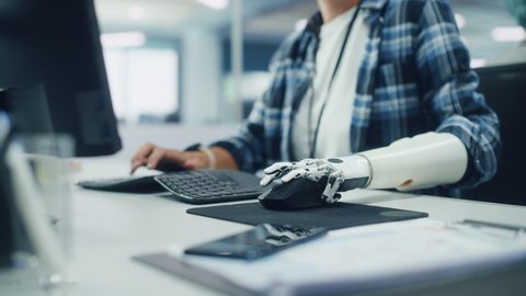 Diverse Office: Person with Disability Using Prosthetic Arm to Work on Computer. Professional with Advanced Thought Controlled Body Powered Myoelectric Bionic Limb to Control Mouse. Focus on Hands