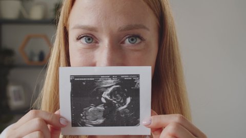 Portrait of blonde woman covering mouth with sonogram image of baby in womb and looking at camera while posing during pregnancy