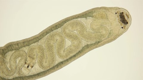 Worm Tetrastemma sp. under the microscope, Nemertea Phylum, vast majority of predators, also scavengers. Work of internal organs is visible. Black Sea