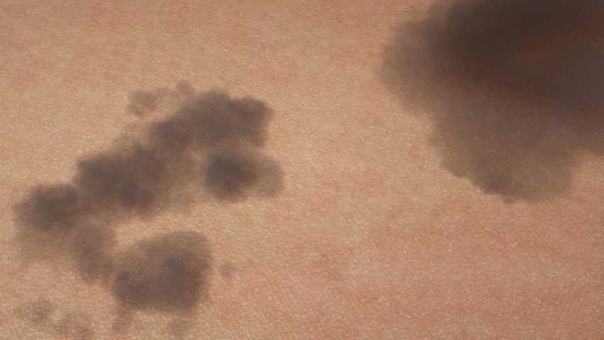 Golden serum drops on the skin to heal and rejuvenate the skin.