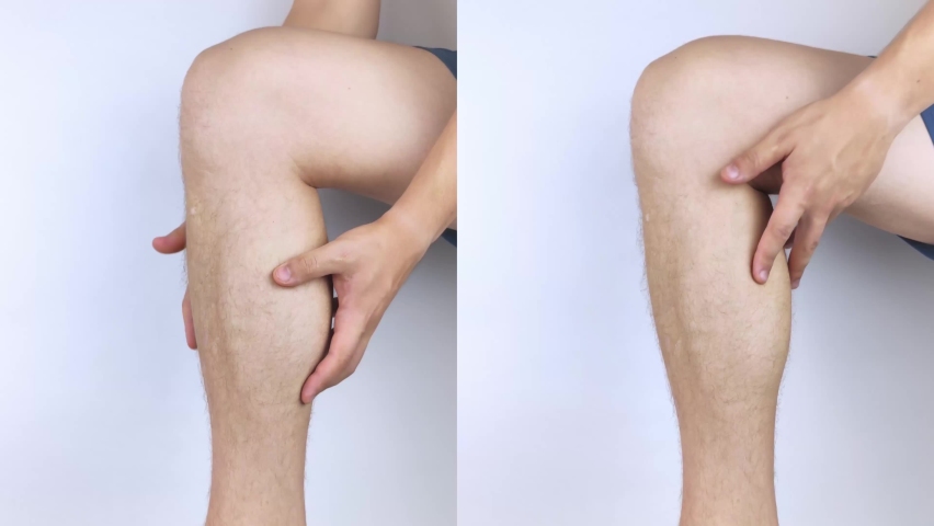 Before and after. On the left man is holding on to the calf muscle because it hurts a lot. On the right doctors have healed the injury and there is no more pain. Ligament sprain and muscle rupture | Shutterstock HD Video #1079396006