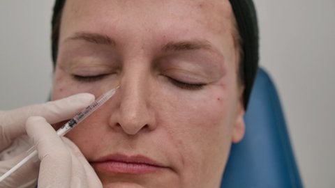 Cosmetic treatment in a clinic. Woman getting an injectable hyaluronic acid to the face. Woman have an anti-aging procedure. 
Forehead lines, Frown lines, Marionette lines, Bunny lines around the nose