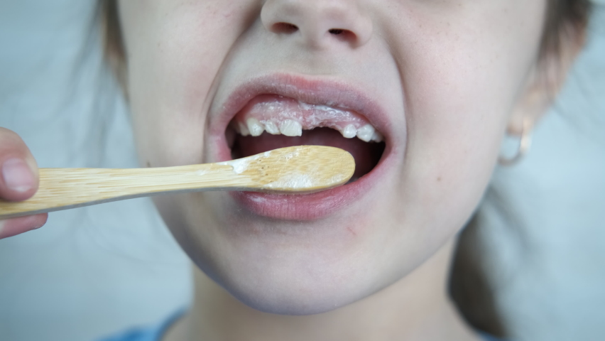 A toothless child is brushing his teeth. A little girl without a tooth brushes her teeth with an eco-brush. | Shutterstock HD Video #1079453201