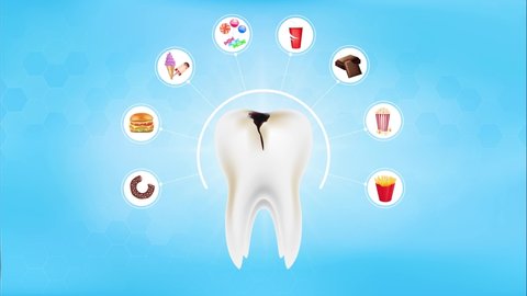 Foods harm healthy teeth. Candy, Eating a lot of sugar is dangerous to health tooth. Caries, decay, cavity. Concept of dental nutrition healthy. On green blue background animated. 4K video footage.