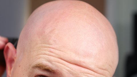 Man shaving bald head with electric razor