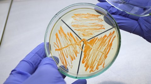 The scientist opens a petri dish with separately grown orange-colored bacteria, examines the bacterium in a sterile laminar flow cabinet and closes the dish, close-up.