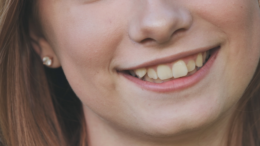 A young girl smiles and shows her crooked teeth. | Shutterstock HD Video #1079905835