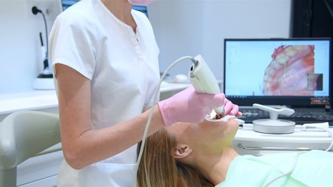Dentist Using 3D Dental Intraoral Scanner For Scanning Teeth Patient's. Modern Dentistry And Healthcare Concept. Slow Motion Effect.