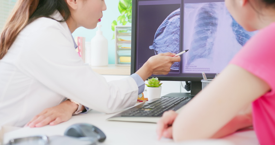 close up of asian woman has breast cancer diagnosis in hospital - female doctor showing mammography test results and xray to patient on computer and explain it Royalty-Free Stock Footage #1080195161