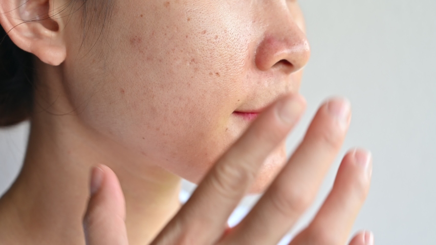 Asian woman applying moisturizer cream for treat and improve her aging skin. Moisturizing everyday can reduce the chance of developing extreme dryness or oiliness. Royalty-Free Stock Footage #1080225236