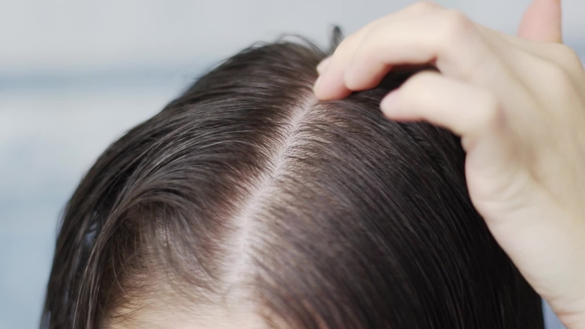 Woman applies oil to hair roots, the process of applying oil to the scalp, woman applies oil to hair roots | Shutterstock HD Video #1080325943