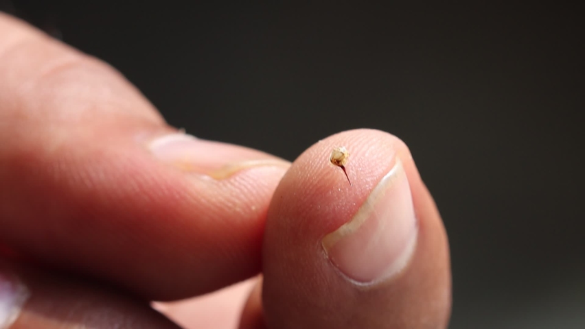 Honey bee sting on finger tip in slow motion | Shutterstock HD Video #1080363176