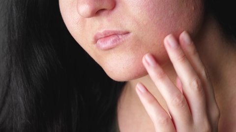 Part of a woman's face. Enlarged pores, irritations and allergies on the skin.