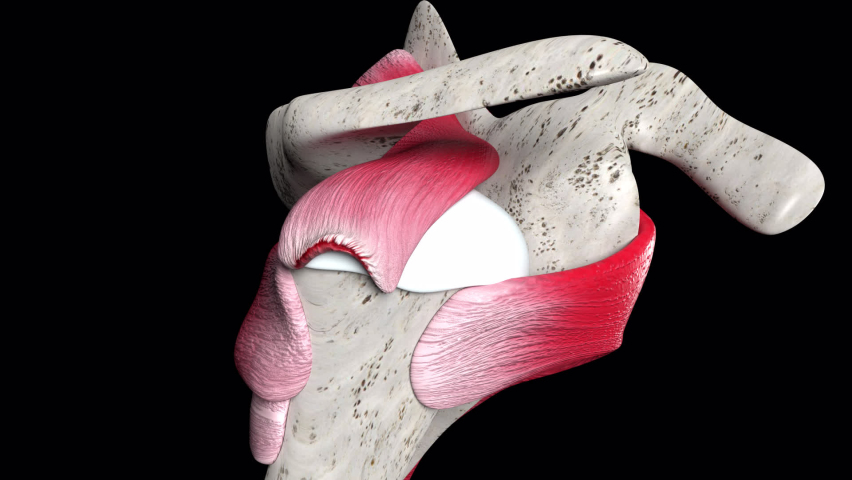 This 3d animation shows a shouder injury with small crescent tear of the rotator cuff | Shutterstock HD Video #1080683438