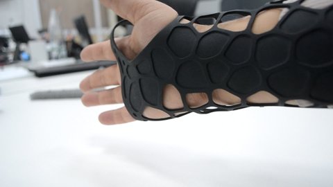 Black orthopedic plastic prosthesis printed on powder 3D printer on hand.