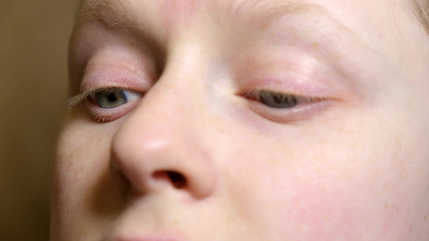 Close-up woman looking at the camera, horizontal nystagmus, woman with uncontrolled rhythmic movements of the eyeballs. eyes health concept | Shutterstock HD Video #1081084961