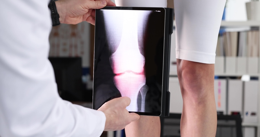 Doctor doing computer examination of knee joint using digital tablet 4k movie Royalty-Free Stock Footage #1081295849