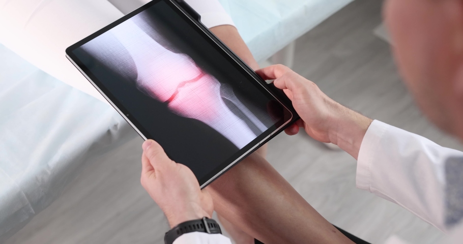 Doctor makes X-ray image of patient sore knee joint 4k movie | Shutterstock HD Video #1081295888