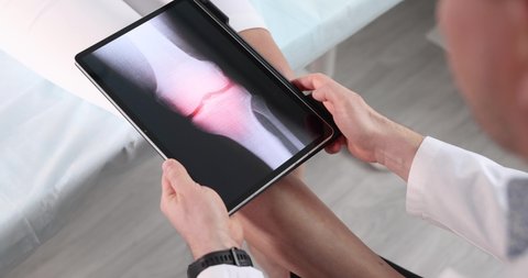 Doctor makes X-ray image of patient sore knee joint 4k movie
