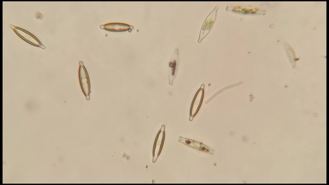 microscopic footage of living microorganisms diatoms in pond water