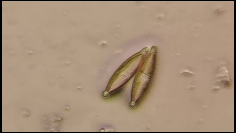 microscopic footage of living microorganisms diatoms in pond water