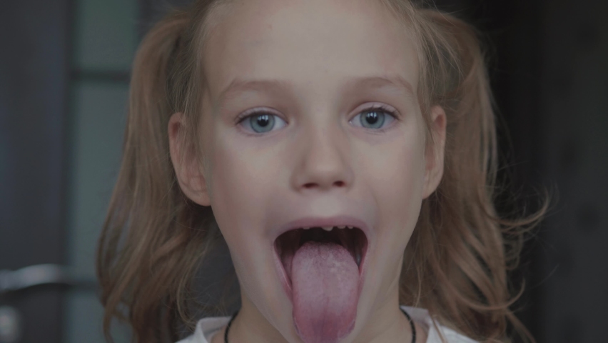Child girl opens her mouth wide. child shows her teeth and mouth to dentist. mouth is wide open, tongue is stuck out as far as possible, with clear view of tongue and soft palate | Shutterstock HD Video #1081466072
