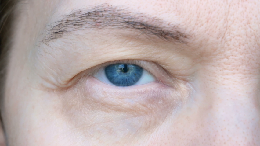 Middle aged female's eye with drooping eyelid. Ptosis is a drooping of the upper eyelid, lazy eye. Cosmetology and facial concept, first wrinkles | Shutterstock HD Video #1081475216