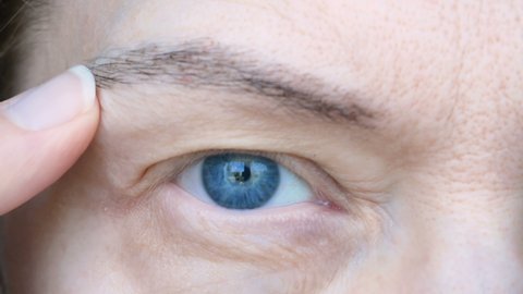 middle aged female's eye with drooping eyelid. Ptosis is a drooping of the upper eyelid, lazy eye. Cosmetology and facial concept, first wrinkles