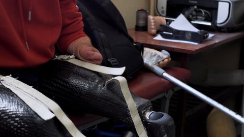 A man living with a disability with amputated legs and arms puts on a modern artificial bionic leg prosthesis trying to fix it with amputated two stump hands
