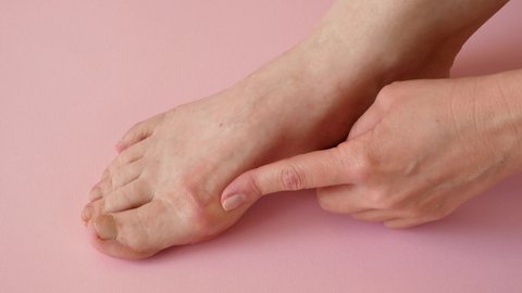 woman's hand massaging her bunion toes in bare feet to relieve pain on pink background Woman feet problem. Hallux valgus.