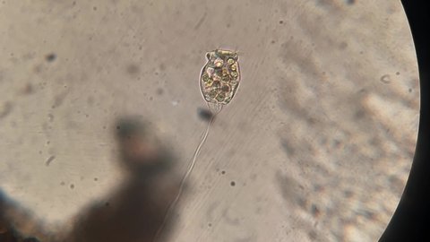 microscopic footage of microorganism vorticella swim in a pond water