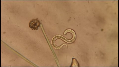 microscopic footage of living microorganisms nematod worm in pond fresh water