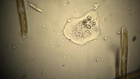 microscopic footage of living microorganisms amoeba in pond fresh water