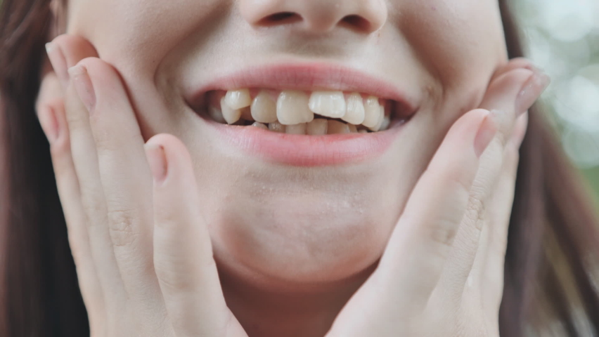 A teenage girl demonstrates her crooked teeth. | Shutterstock HD Video #1082113094