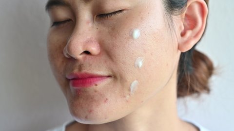 Asian woman applying moisturizer cream for treat and improve her aging skin. Moisturizing everyday can reduce the chance of developing extreme dryness or oiliness.
