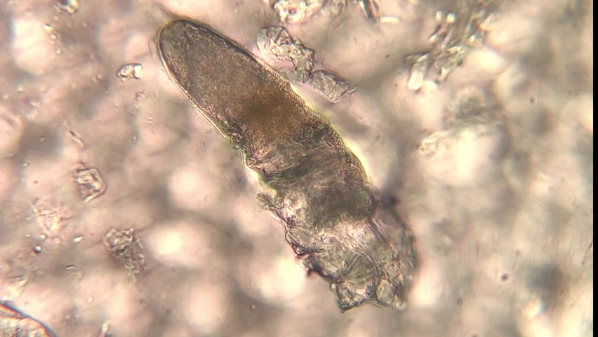 microscopic footage of Demodex or face mites Royalty-Free Stock Footage #1082280574